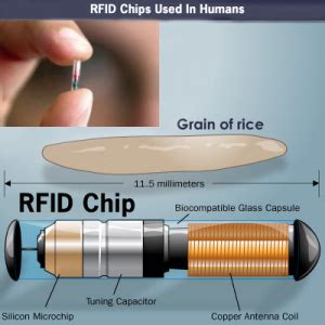 hanna wyoming rfid chip snopes|rfid chip implantation.